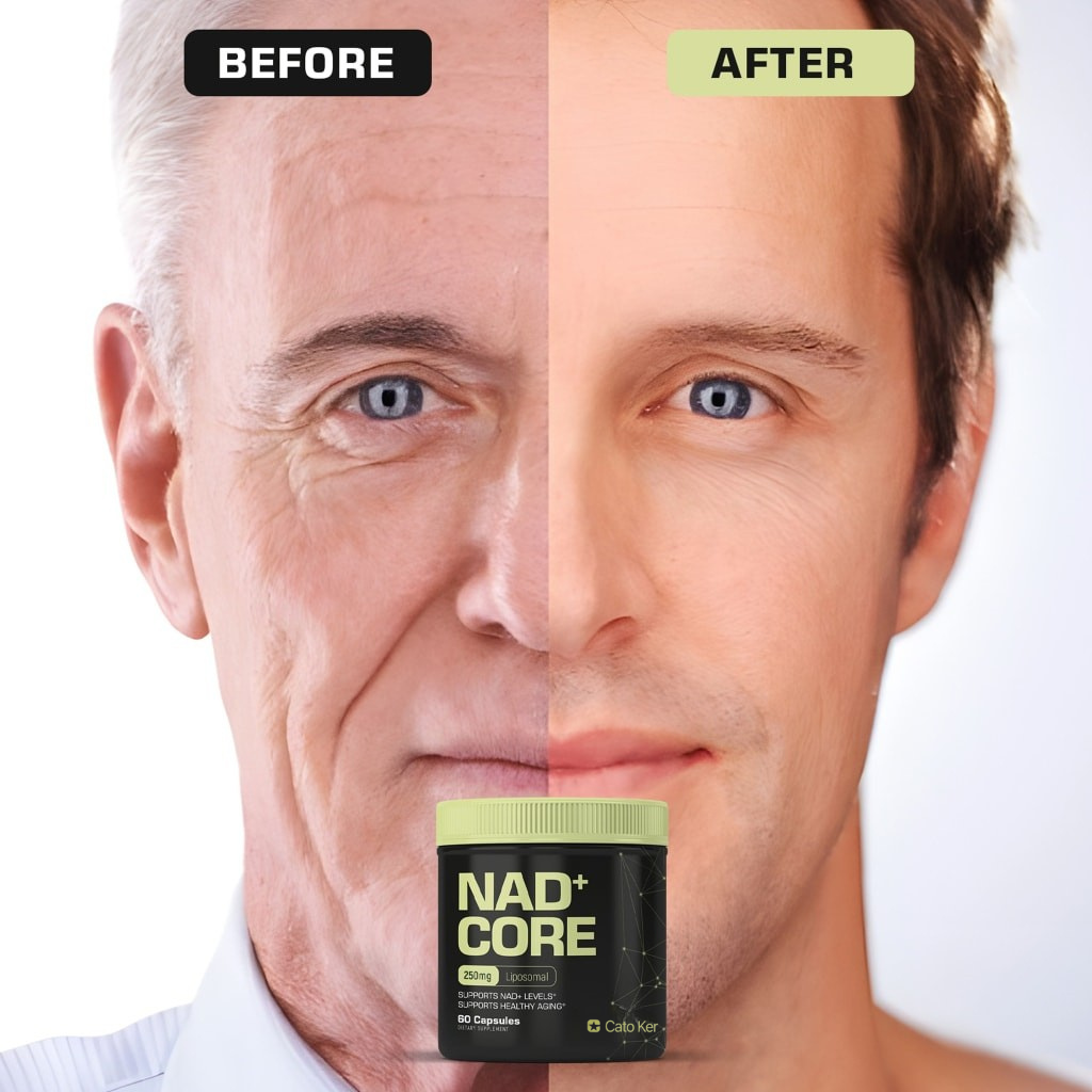 Cato Ker NAD+ Nicotinamide Riboside